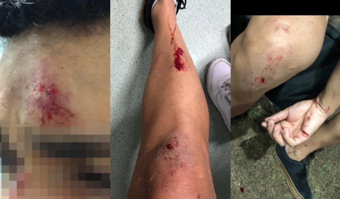 Casal gay é agredido durante corrida de aplicativo no Graciliano Ramos