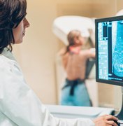 Mamografias caem 75% durante pandemia; médica fala sobre a importância do exame
