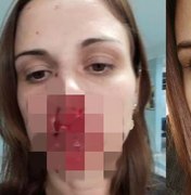Mulher acusa ex-marido de agressão e posta foto com rosto ensanguentado