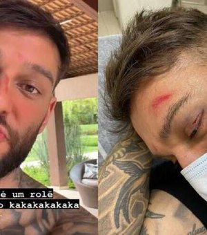 Lucas Lucco assusta fãs ao mostrar rosto desfigurado e dedo quebrado após acidente
