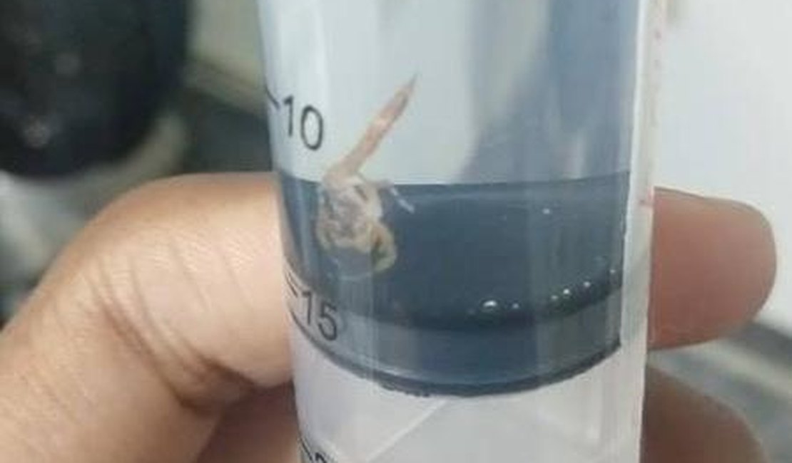 Pais encontram escorpião dentro da roupa de recém-nascido em hospital