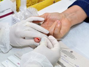 Ambulatório da Sesau atende pacientes em estágio inicial do HIV