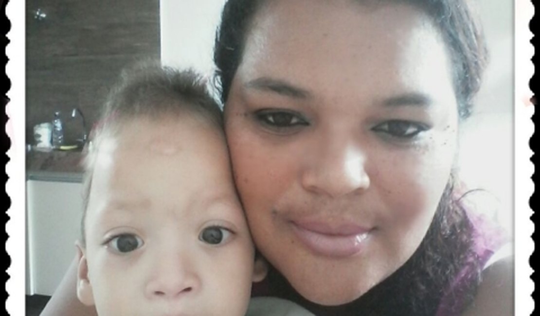 Mãe adotiva luta pela vida do filho e pede ajuda para tratamento de escafocefalia