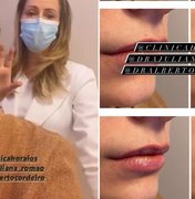Ex de Luan Santana, Jade Magalhães faz preenchimento labial; veja resultado