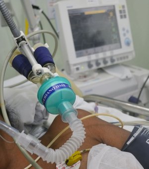 Hospital Helvio Auto reduz a zero pneumonias associadas à intubação de pacientes
