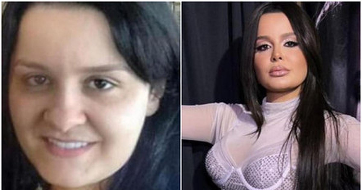 Antes E Depois De Maraisa Viraliza E Choca Web Mudou Muito