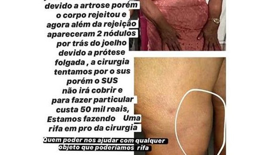 Família e amigos pedem ajuda para custear cirurgia no joelho de idosa