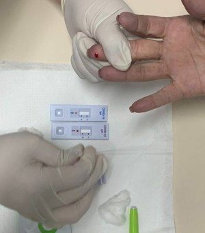 Vigilância Sanitária estabelece novas regras para testes rápidos em farmácias