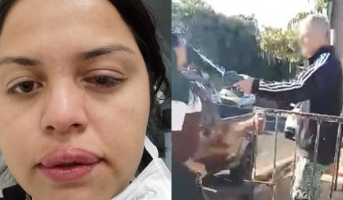 Ex-patrão atira soda cáustica contra o rosto de faxineira