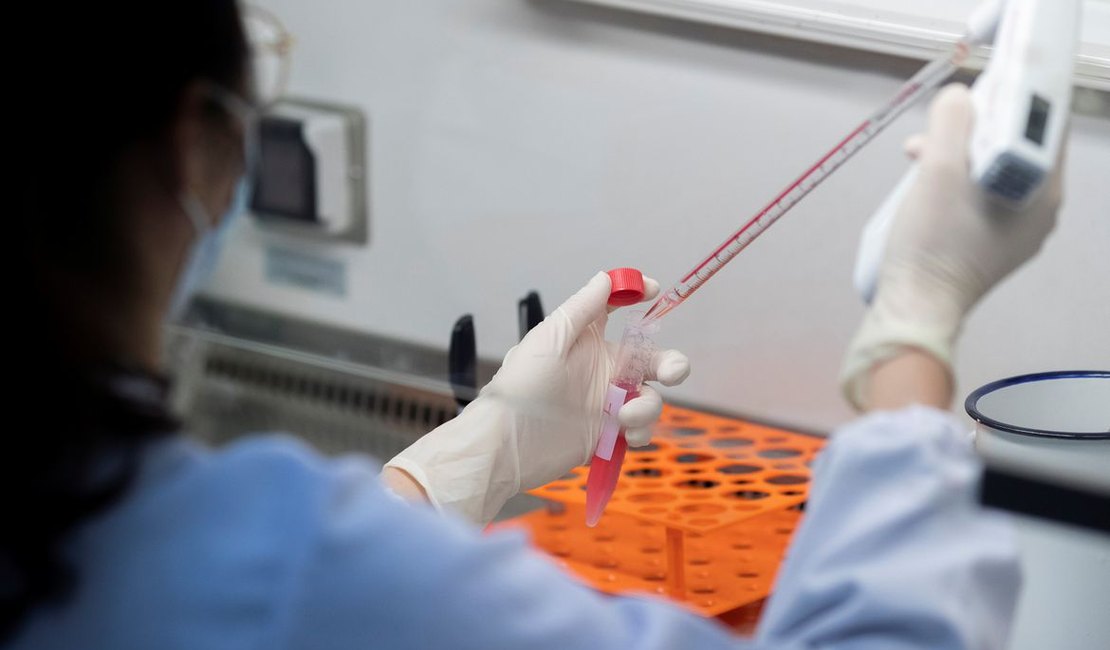 Fiocruz vai produzir 2,4 milhões de testes para diagnosticar coronavírus