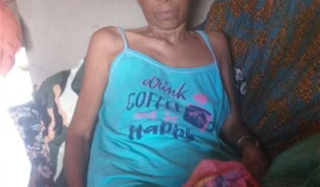 Moradora de maceió pede ajuda para comprar fraldas geriatricas devido a um tratamento e câncer