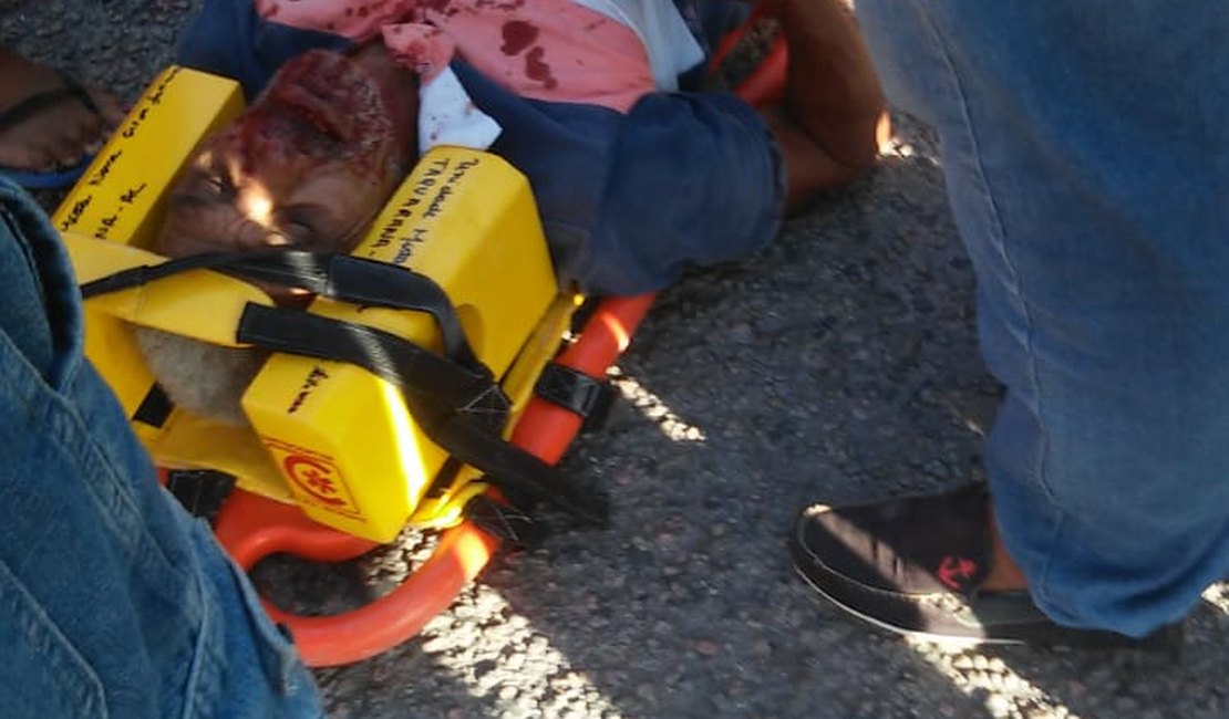 Acidente deixa quatro pessoas gravemente feridas em Taquarana