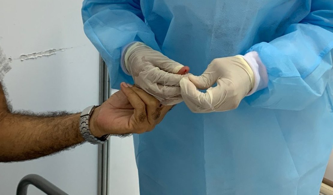 Arapiraca ultrapassa 9.700 casos confirmados de Covid-19