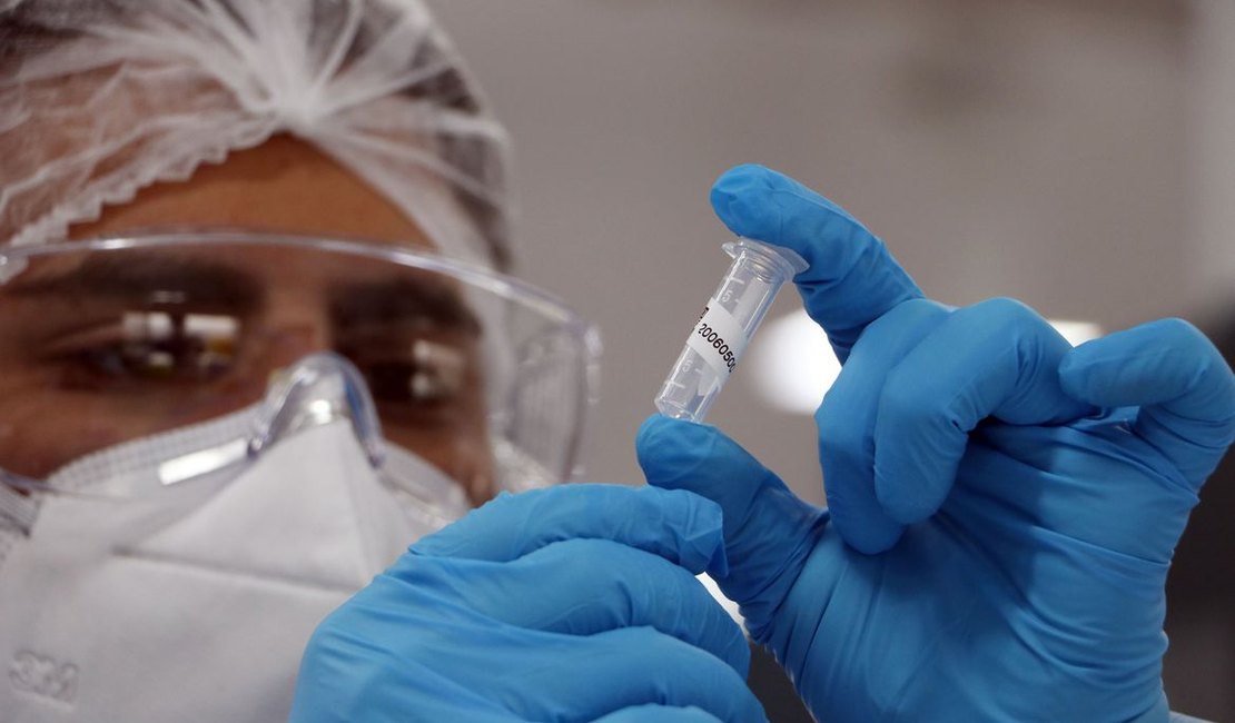 Fiocruz vai pagar R$ 59,4 milhões por vacinas de Oxford importadas da Índia