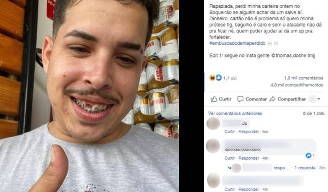 Rapaz perde dente da frente, faz pedido na internet e viraliza