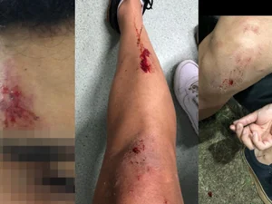 Casal gay é agredido durante corrida de aplicativo no Graciliano Ramos