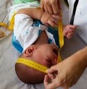 Zika: risco de microcefalia em fetos varia entre 1% e 13%, mostra estudo