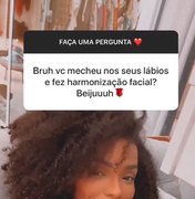 Brunna Gonçalves revela antes e depois da harmonização facial