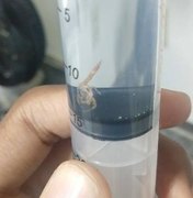 Pais encontram escorpião dentro da roupa de recém-nascido em hospital 