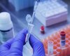 O que se sabe sobre os primeiros casos confirmados da variante Ômicron no Brasil