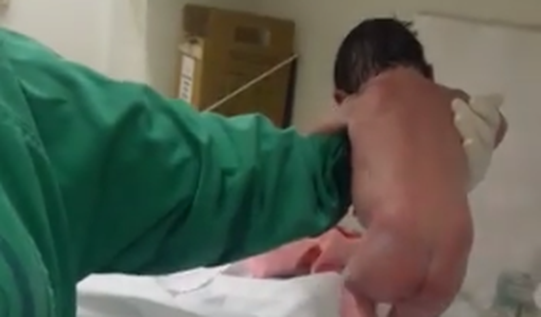 Bebê 'sai andando' logo após o parto e vídeo viraliza; pediatra explica a cena
