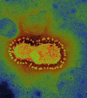 Nível de anticorpos cai rapidamente após infecção, apontam estudos
