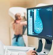 Alagoanas deixam de realizar mamografia e números preocupam especialistas
