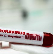 Na UTI, idosa aguarda resultado do exame de coronavírus há 8 dias