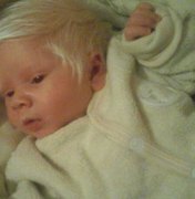 Bebê faz sucesso ao nascer com o cabelo todo branco