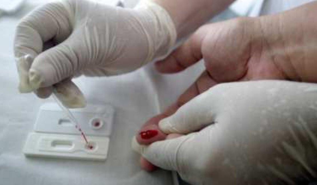 Em Arapiraca já foram notificados 34 casos de Aids