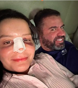Maraisa faz diversos agradecimentos após sofrer fratura no nariz em Alagoas