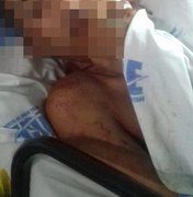 Jovem de 19 anos troca tiros com a PM em Maceió, é atingido no rosto e sobrevive
