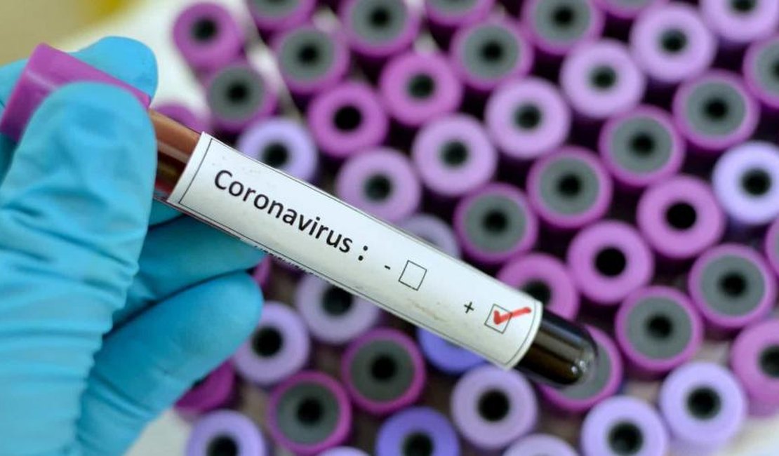Maceió passa dos 500 casos do novo coronavírus