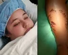 Jovem sobrevive após ser atacada por crocodilo e puxada para debaixo d'água