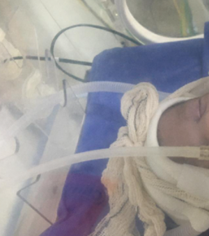 João Arthur: bebê com fibrose cística é transferido para a Santa Casa, em Maceió