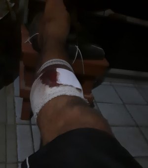 [Vídeo] Jovem desacata ordem policial e é atingido por um bala de borracha, em Porto Calvo