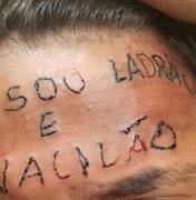 Coletivo arrecada quase R$ 20 mil para apagar tatuagem da testa de adolescente