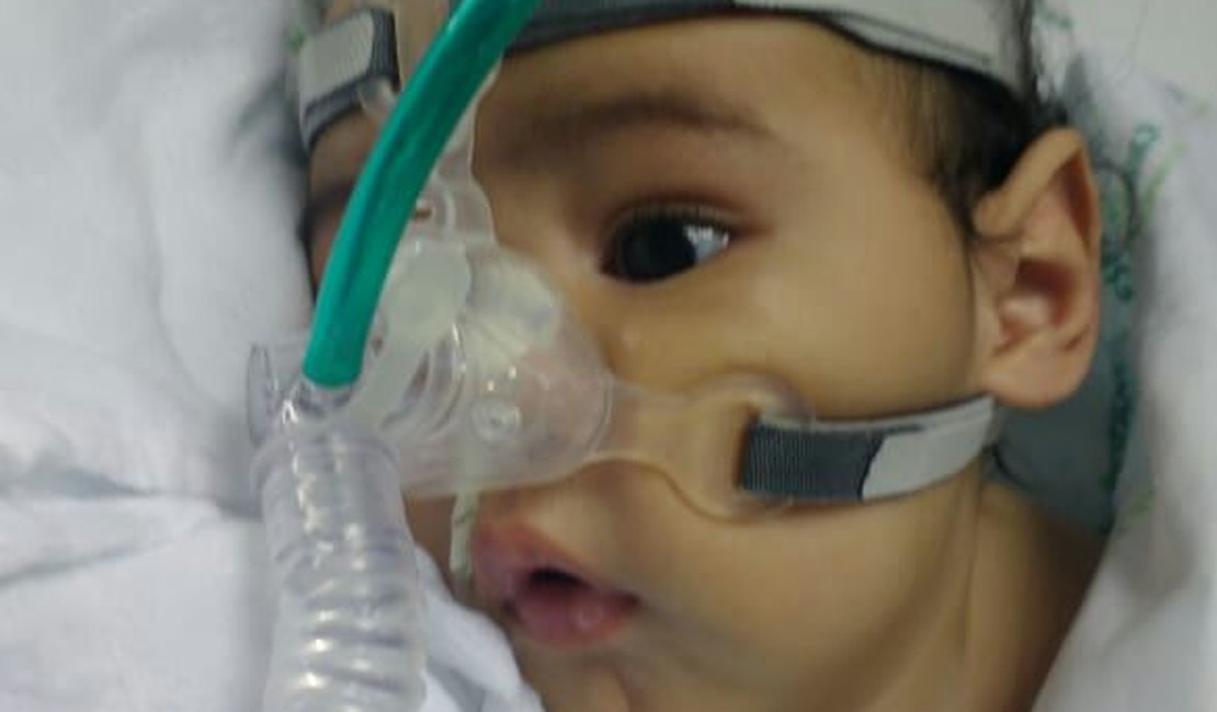 Familiares apelam para salvar bebê de Ibateguara diagnosticado com doença rara
