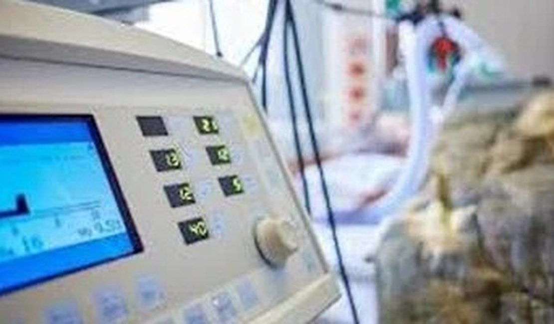 Governo de AL vai pedir novos respiradores ao Ministério da Saúde