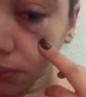 Mulher é agredida com soco no olho dentro de van no interior de Alagoas