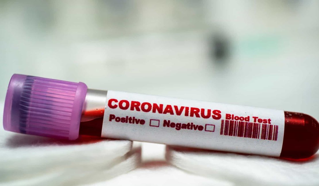 Coronavírus: mulher de 32 anos é a 18ª vítima fatal no RJ