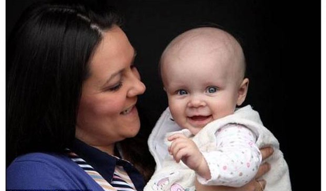 Bebê passa por quimioterapia aos sete meses de idade