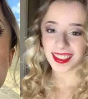 Garota com dentes 'transparentes' gasta R$ 49 mil para ganhar novo sorriso