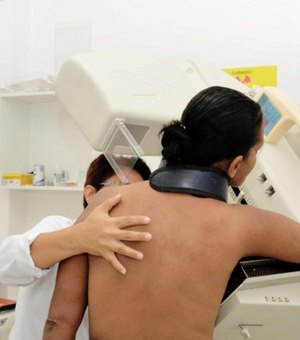 Sesau destaca importância do diagnóstico precoce de câncer de mama