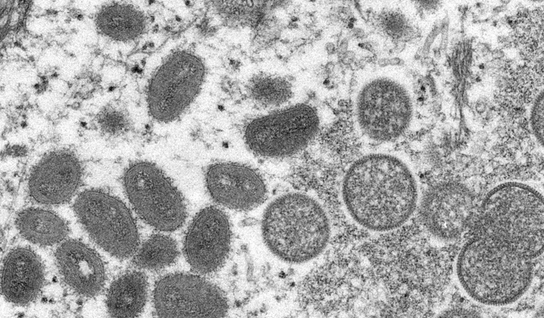 Brasil investiga dois casos suspeitos da varíola do macaco