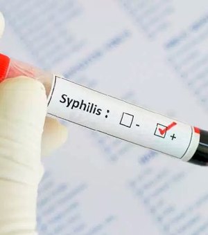 Número de casos de sífilis no Brasil aumenta 16 vezes; doença cresce 11,8% em Alagoas