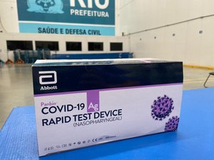 Rio recebe 10 mil testes de Covid e pretende começar exames nesta segunda-feira