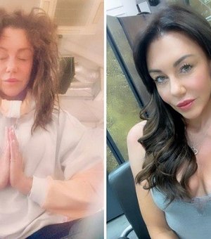 Cantora mostra efeito devastador de drogas e álcool nos seus cabelos em fotos de antes e depois