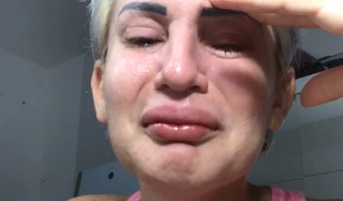 Romagaga chora ao perder conta de 1,6 milhão de seguidores no Instagram