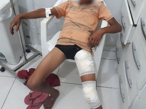 Menor de 14 anos é alvejado com tiro de espingarda em União dos Palmares